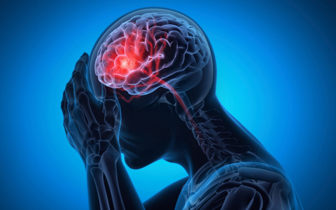 What Is Idiopathic Intracranial Hypertension (IIH)? Understanding Pressure Inside the Brain